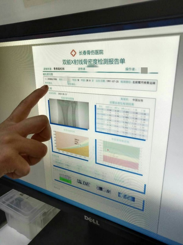 品源雙能X射線骨密度儀落戶吉林省長春骨傷醫(yī)院，助力骨松診療