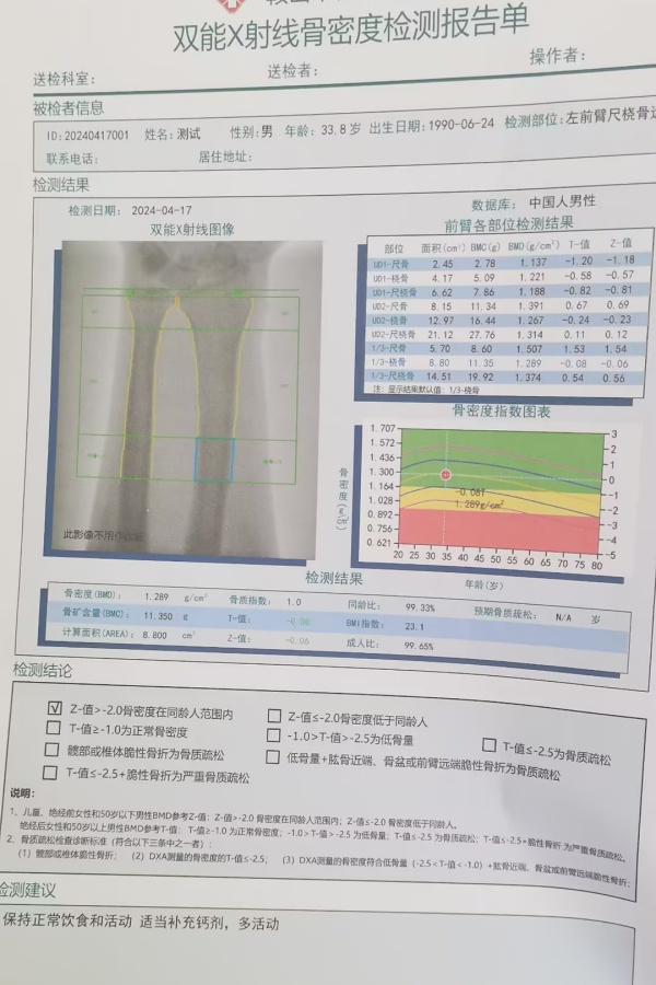 雙能X射線骨密度儀：準確測量骨密度，助力骨質(zhì)疏松防治，守護骨骼健康